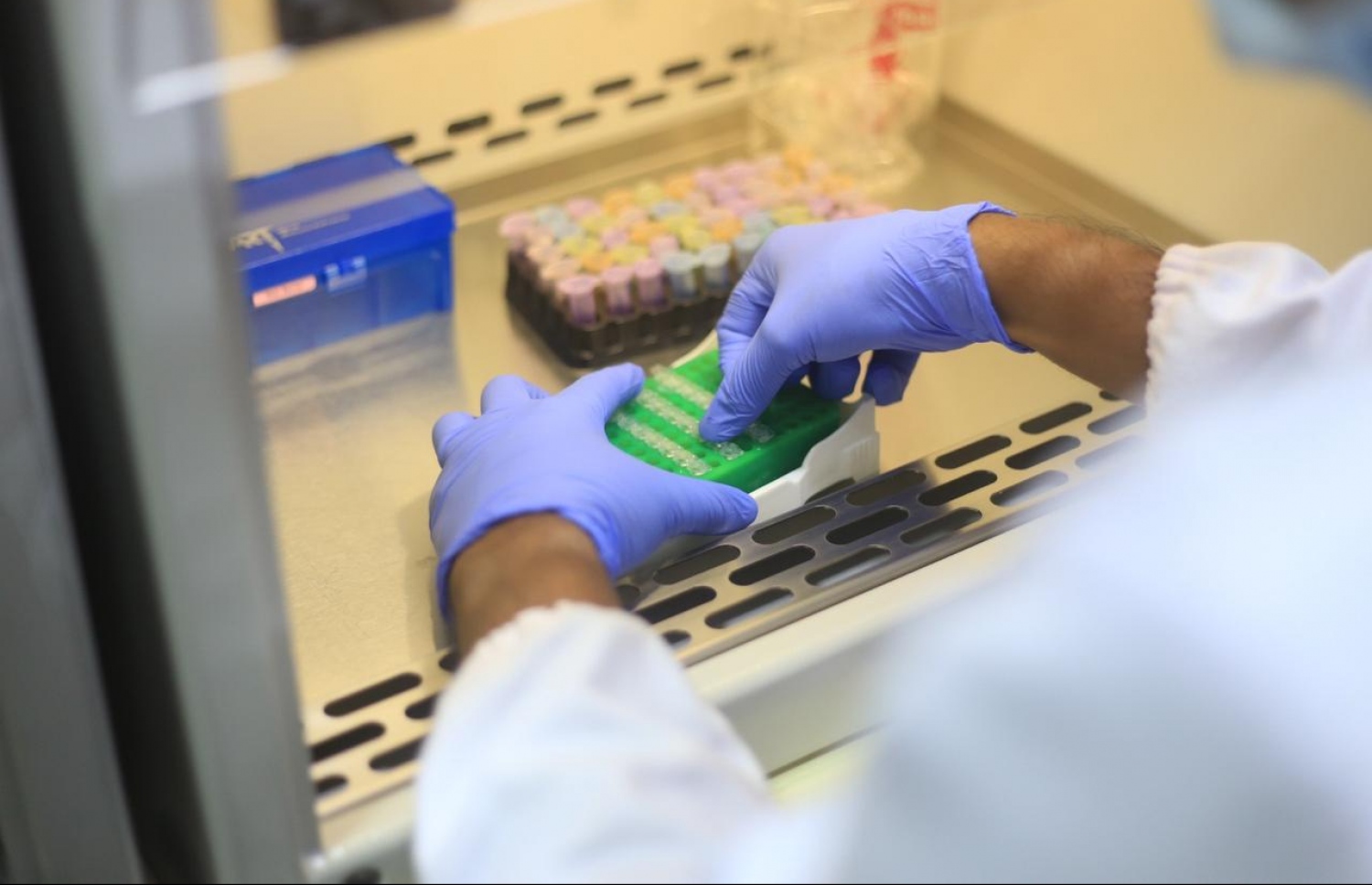 އައިޖީއެމްއެޗުގެ ލެބޯޓްރީގައި ސާމްޕަލްތަކެއް ޓެސްޓްކުރަނީ.