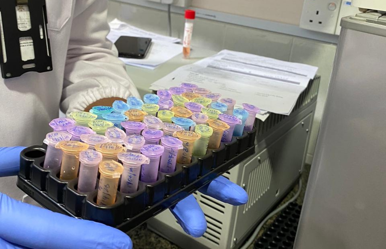 އައިޖީއެމްއެޗުގައި، ޓެސްޓްކުރަން ސާމްޕަލް ތައްޔާރުކޮށްފައި.