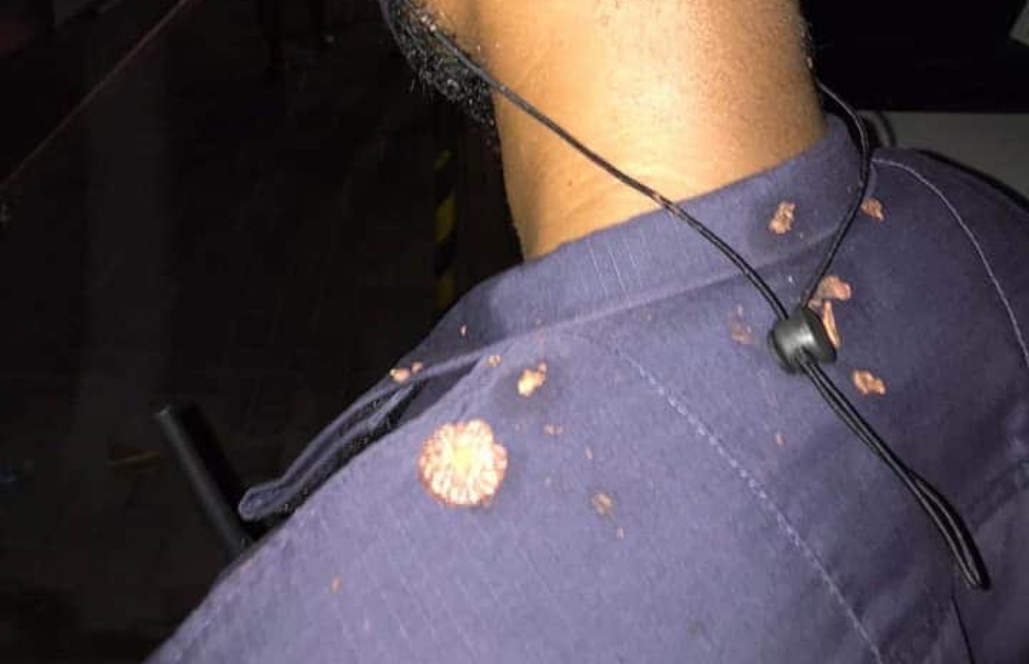 ފުލުސް މީހާގެ ގަޔަށް ހައްޕުނޑު ޖަހާފައި: އެ މައްސަލަ ތަހުގީގު ކުރާނެ ކަމަށް ފުލުހުން ބުނޭ-- ފޮޓޯ: ޕޮލިސް