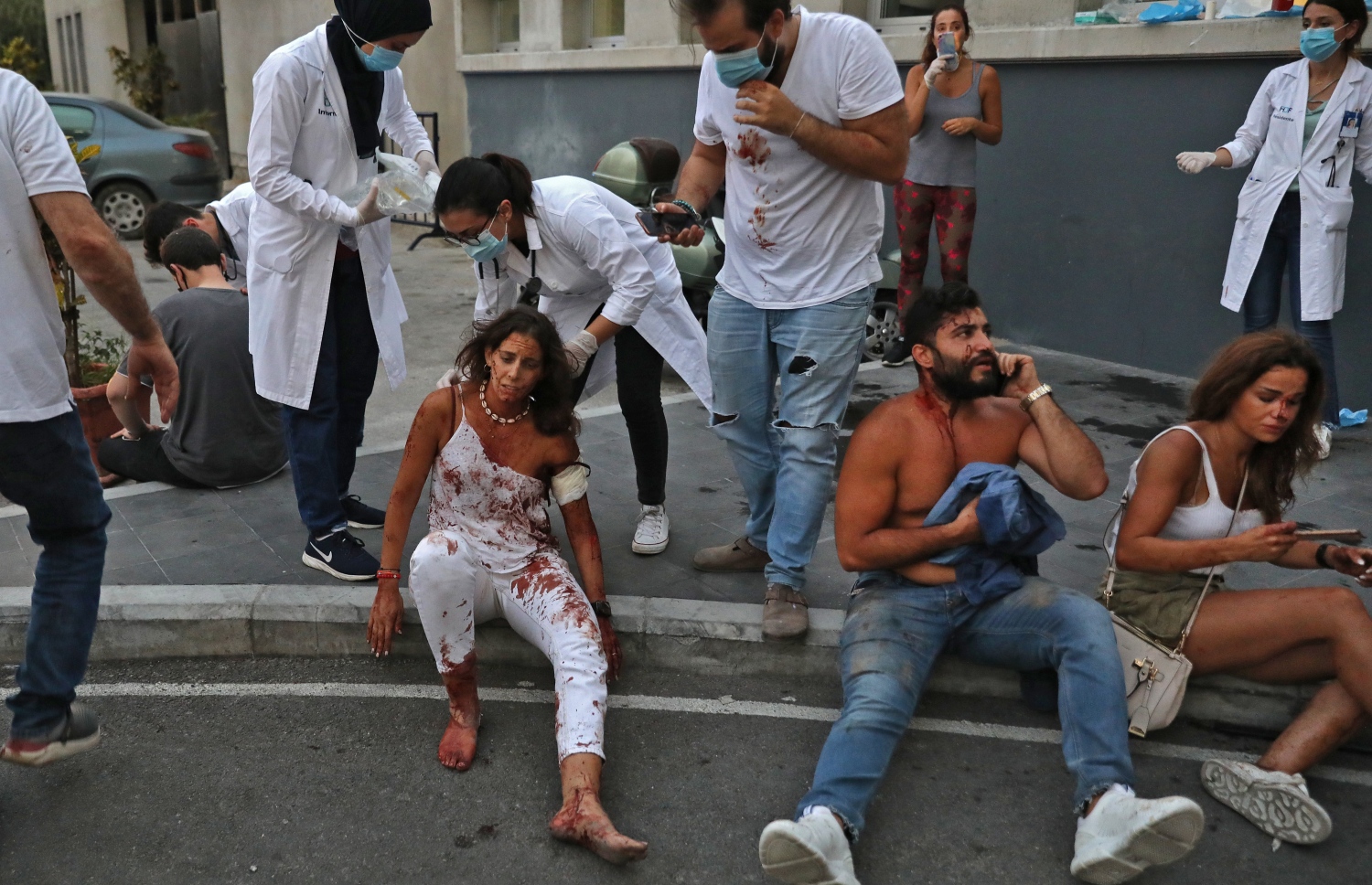 ބޭރޫތު- އޮގަސްޓް 4، 2020: ލުބުނާނުގެ ވެރިރަށް ބޭރޫތުގެ ކެމިކަލް ގުދަނެއް ގޮވުމުން ޒަޚަމްވި މީހުން ހޮސްޕިޓަލްގެ ބޭރުގައި. --ފޮޓޯ:އޭއެފްޕީ