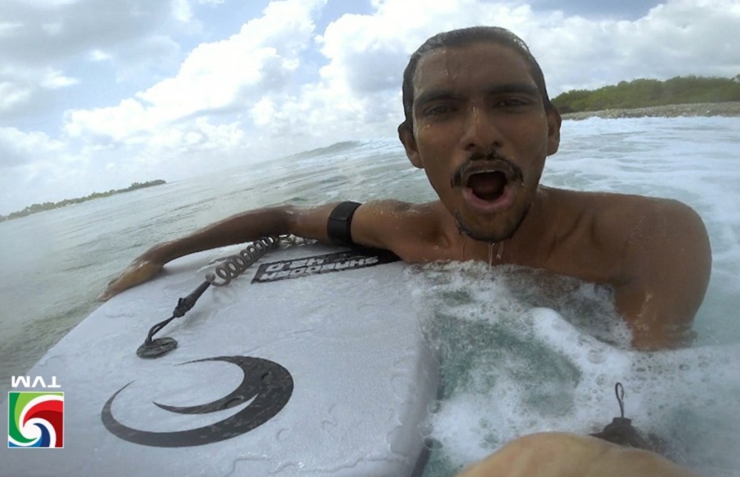 ނާއިލް ތަނބުރުދޫ މޫދަށް ފައިބާ ނަގާފައިވާ ފޮޓޯއެއް