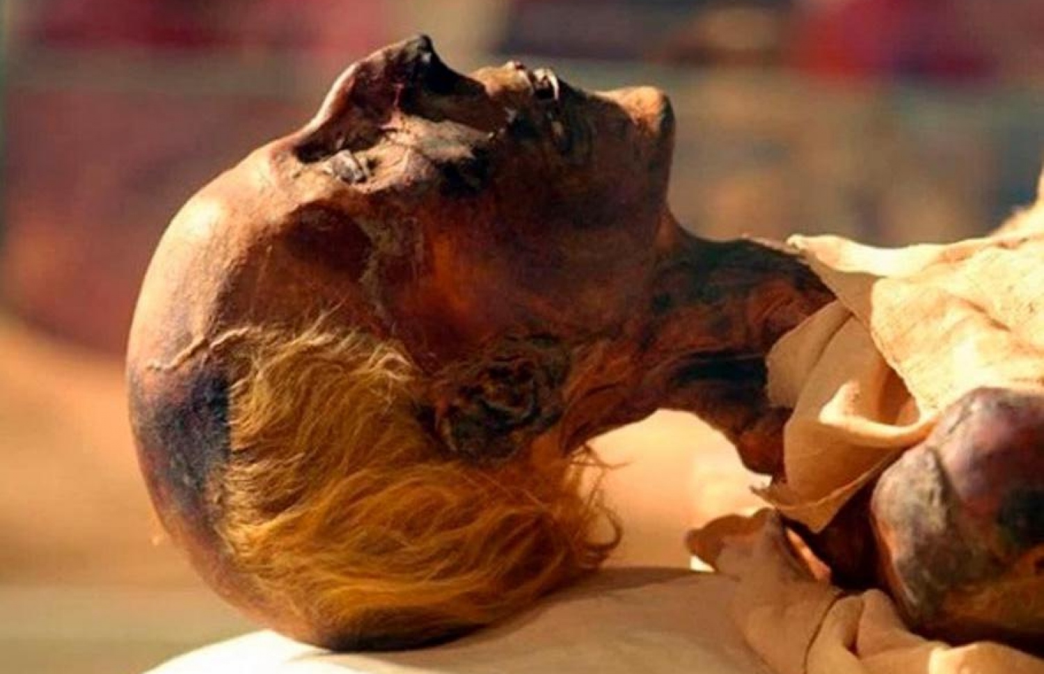 ފިރުއައުނު ރަމްސެސް (ދެ ވަނަ) ގެ ހަށިގަނޑު