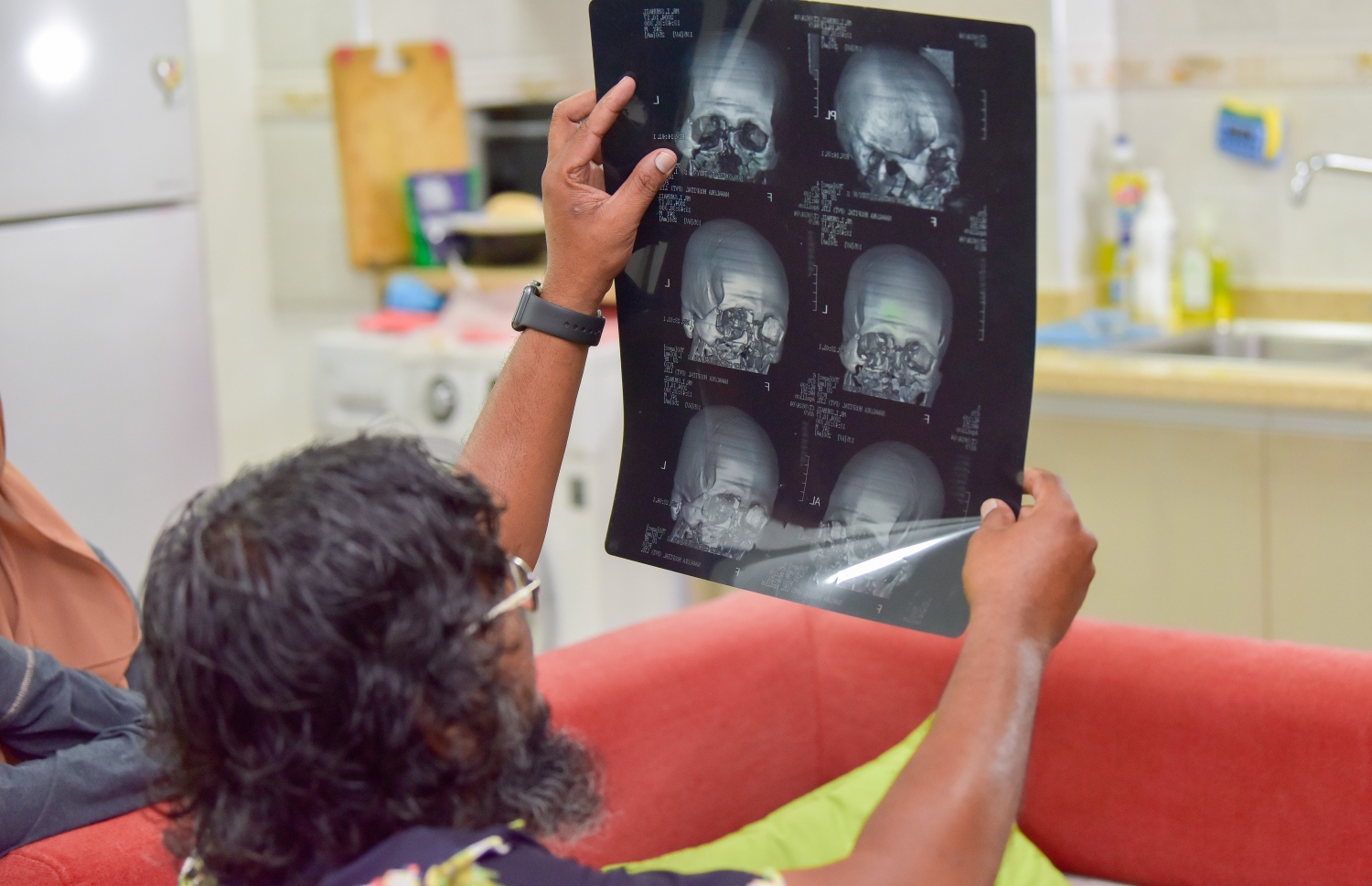 އެކްސިޑެންޓްގައި ބޮލަށް ލިބިފައިވާ ގެއްލުންތަކުގެ އެކްސްރޭއެއް