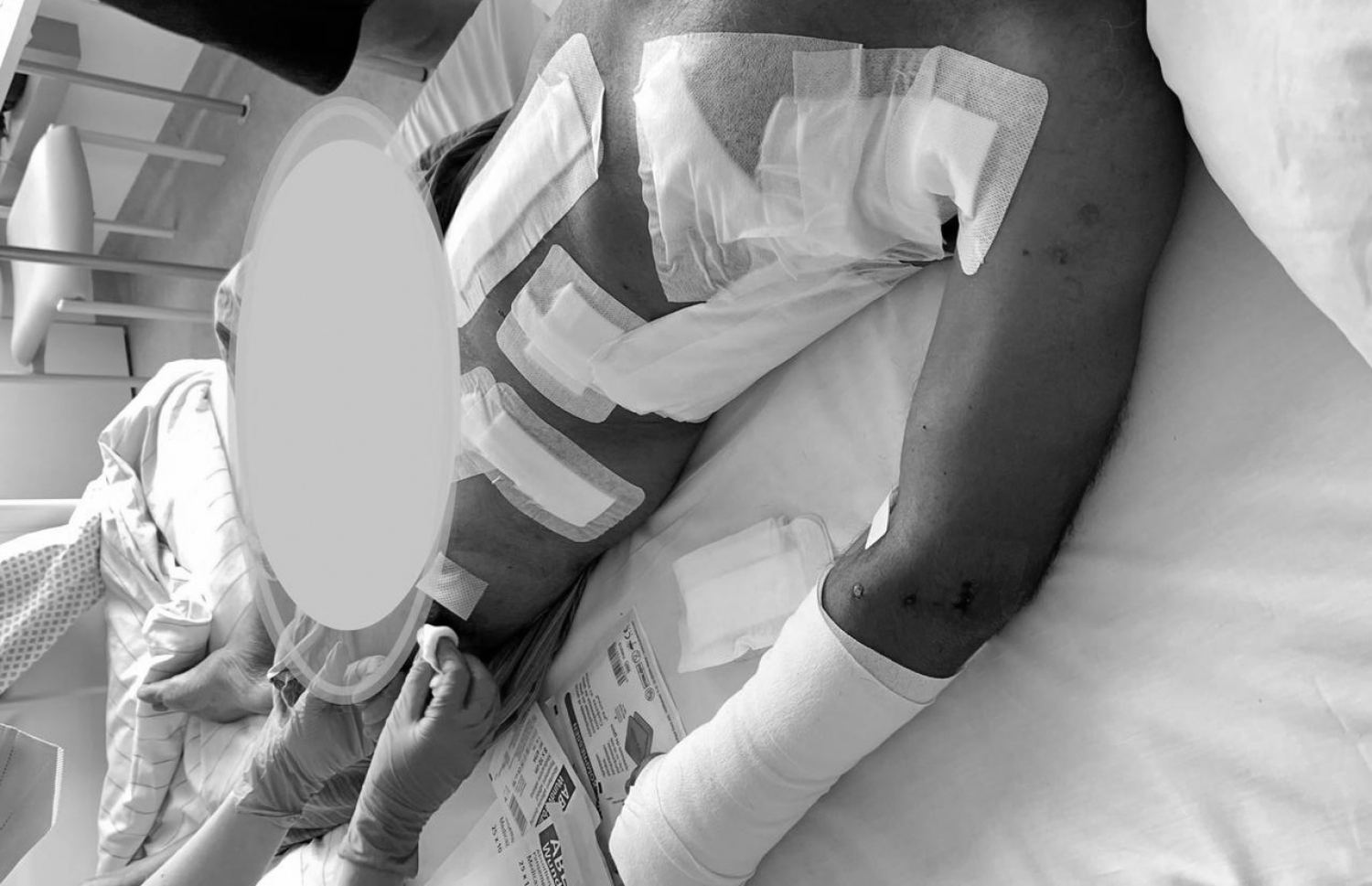 ނަޝީދަށް ދިން ޓެރަރިސްޓް ހަމަލާގައި ލިބިފައިވާ ޒަހަމްތައް ފެންނަ ފޮޓޯއެއް