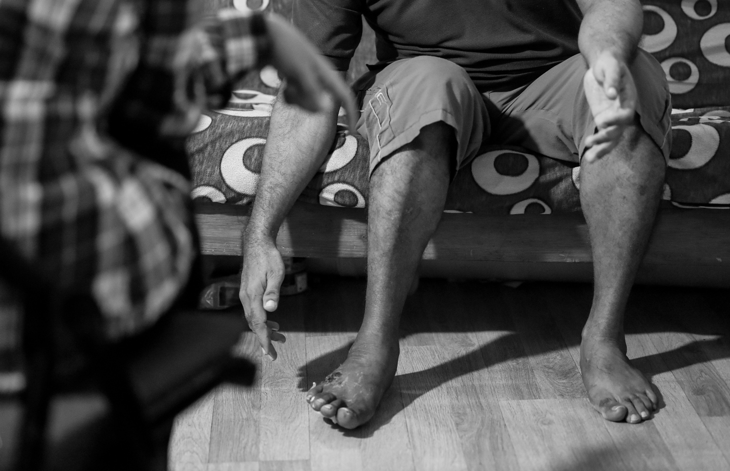 ހަމަލާގައި ޒަހަމްވި އާދަމްގެ ކަނާތު ފަޔަށް ލިބިފައި ހުރި ގެއްލުންތައް ދައްކާލަނީ.-- ފޮޓޯ: ނިޝާން އަލީ/ މިހާރު