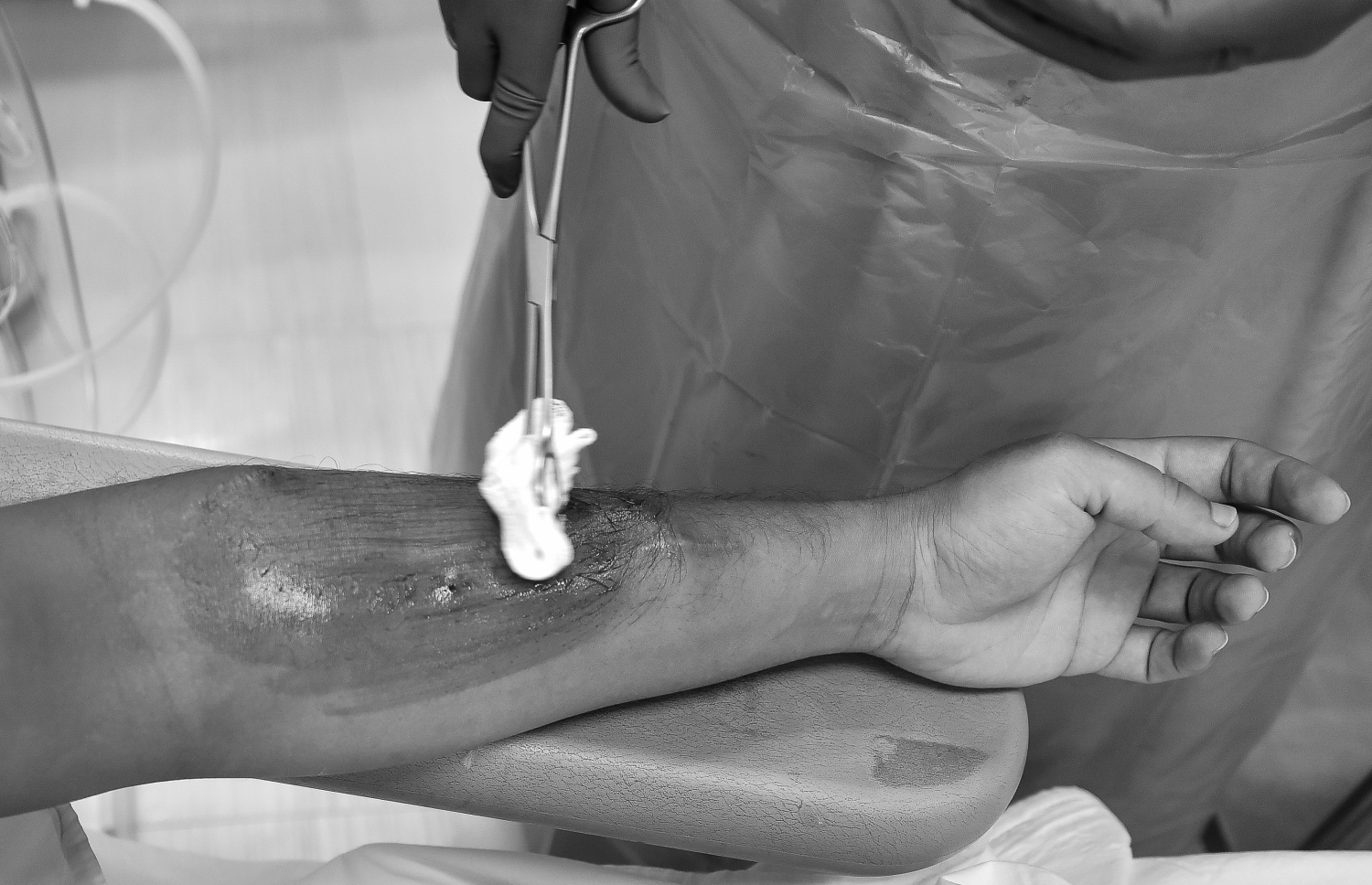 ޑައިލިސިސް ހެދުމަށް ސައިމަންގެ އަތަށް ހޮޅި ގުޅުމުގެ ކުރިން ބޭސް އުނގުޅަނީ