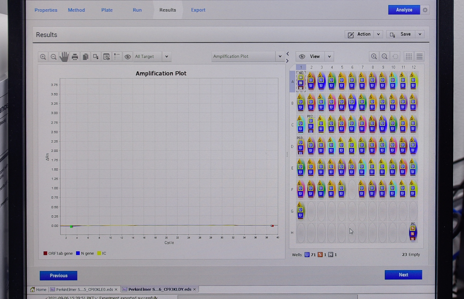 މާލެ- ސެޕްޓެމްބަރު 13، 2021: މެޑިފްލެކްސް ލެބޯޓަރީގައި ކޮވިޑް ސާމްޕަލެެއްގެ ނެގެޓިވް ނަތީޖާއެއް ދައްކާލަނީ: ރާއްޖޭގައި އާންމުކޮށް ހަދާ ހުރިހާ ލެބޯޓަރީ ޓެސްޓެއް ހަދަން ބޭނުންވާ އެންމެ ފަހުގެ ޒަމާނީ އިކުއިޕްމަންޓްސް އެތާނގައި މިހާރު ވެސް އެބަހުރި --. ފޮޓޯ: ނިޝާން އަލީ/ މިހާރު