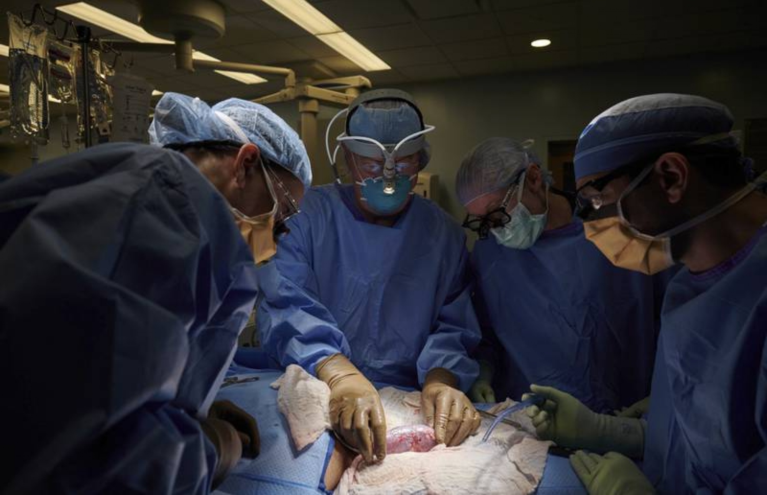 އެމެރިކާގެ އެންވައިޔޫ ލެންގޮން ހެލްތުގެ ޑޮކްޓަރުންގެ ޓީމުން، މީހެއްގެ ހަށިގަނޑުގައި އޫރެއްގެ ކިޑްނީ އިންދުމުގެ އޮޕަރޭޝަން ސެޕްޓެމްބަރު 2021 ގައި ކުރަނީ.