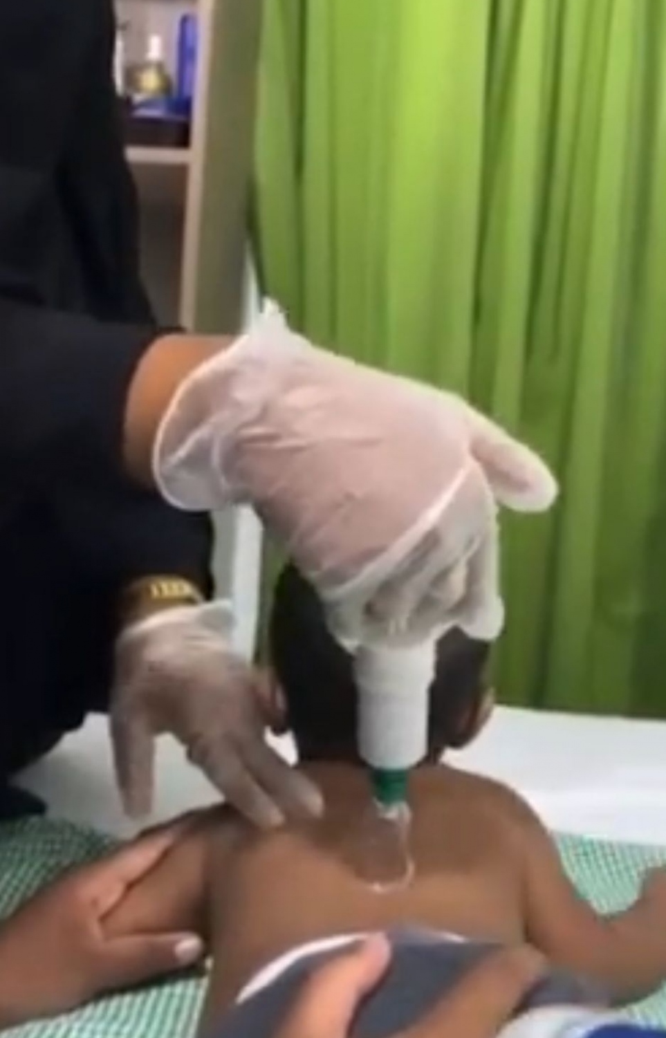 ފަޒީގެ ހިޖާމާ ކްލިނިކްގައި ކުޑަކުއްޖަކު ހިޖާމާ ޖަހަނީ