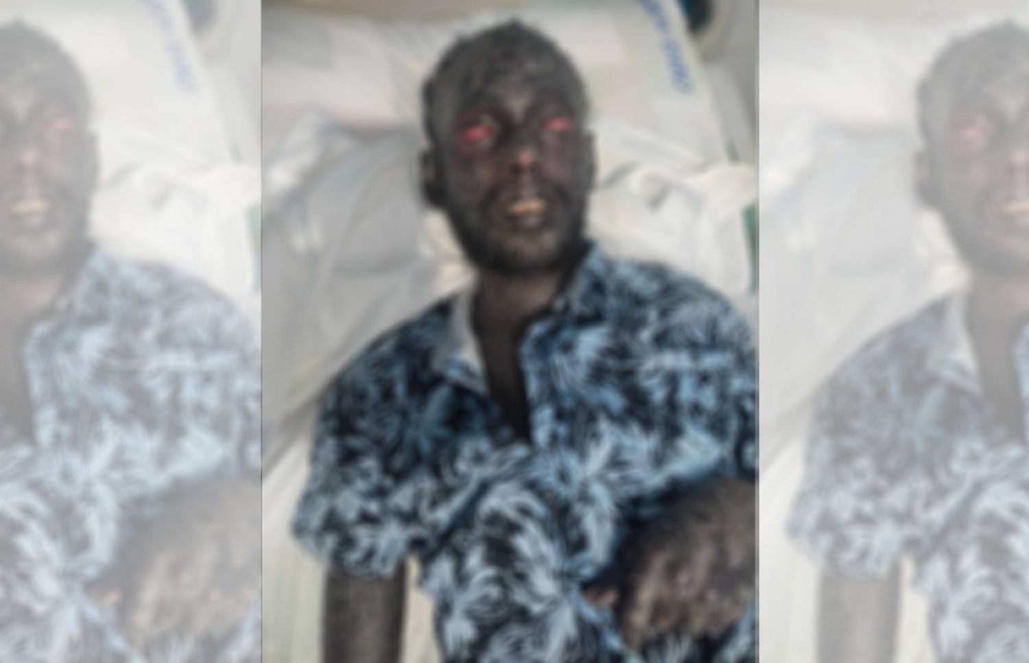 އާދަމް ފާރޫގުގެ ބަލި ހާލު ބޮޑުވެ ލޮލުގެ މަތީ ހަންގަނޑު ލޯމައްޗަށް ވެއްޓިފައި.