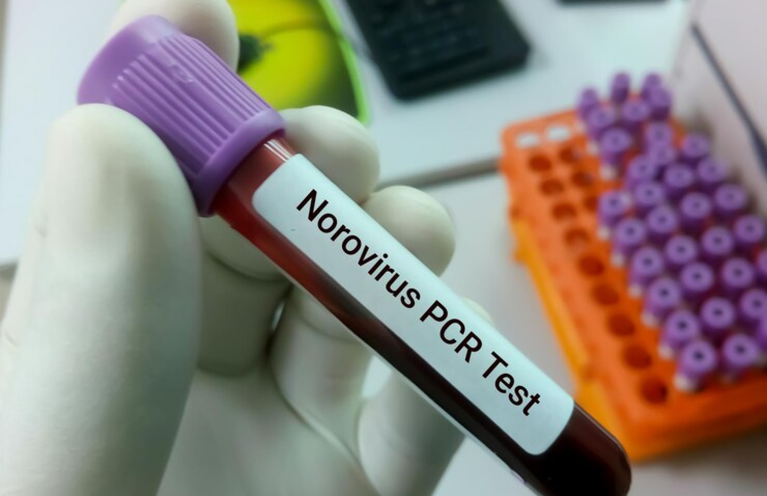 ނޯރޯވައިރަސް އަށް ޖެހިފައިވާ ކަމަށް އާންމުކޮން ނިންމަނީ ބަލީގެ އަލާމާތްތަކަށް ބަލައިގެން