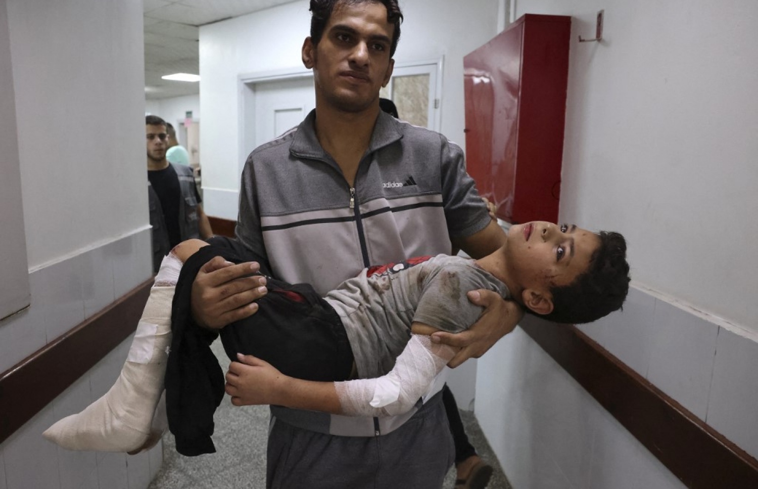 އިޒްރޭލުން ދިން ވައިގެ ހަމަލާއެއްގައި ޒަހަމްވި ކުއްޖަކަށް ފަރުވާ ދިނުމަށް ހޮސްޕިޓަލުގައި.-- ފޮޓޯ: އޭއެފްޕީ