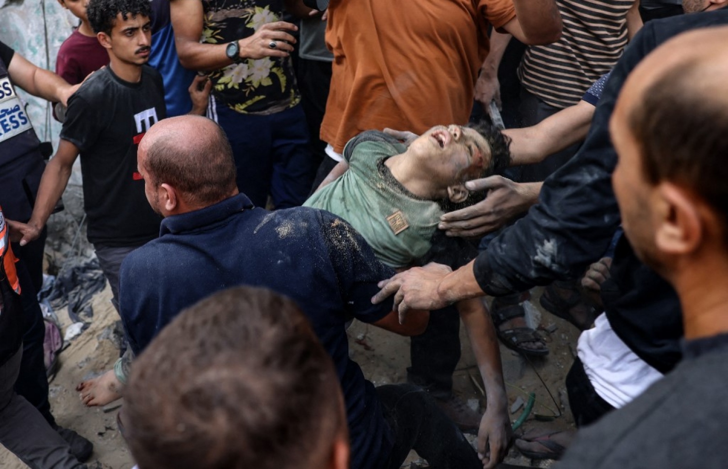 އިޒްރޭލުން ދިން ވައިގެ ހަމަލާއެއްގައި ޒަހަމްވެފައިވާ ކުއްޖަކަށް ފަރުވާ ދިނުމަށް ރެސްކިއު ޓީމުން އެހީތެރިކަން ފޯރުކޮށްދެނީ.-- ފޮޓޯ: އޭއެފްޕީ