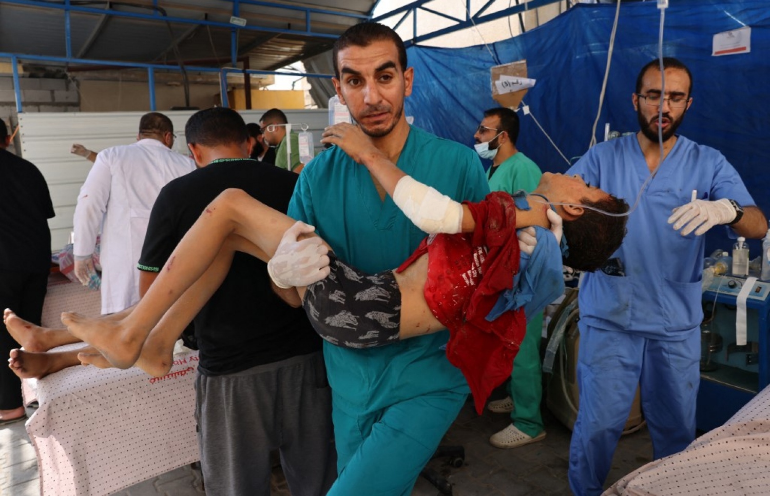 އިޒްރޭލުން ދިން ވައިގެ ހަމަލާއެއްގައި ޒަހަމްވި މީހަކަށް ފަރުވާދިނުމަށް ހޮސްޕިޓަލުގައި.-- ފޮޓޯ: އޭއެފްޕީ