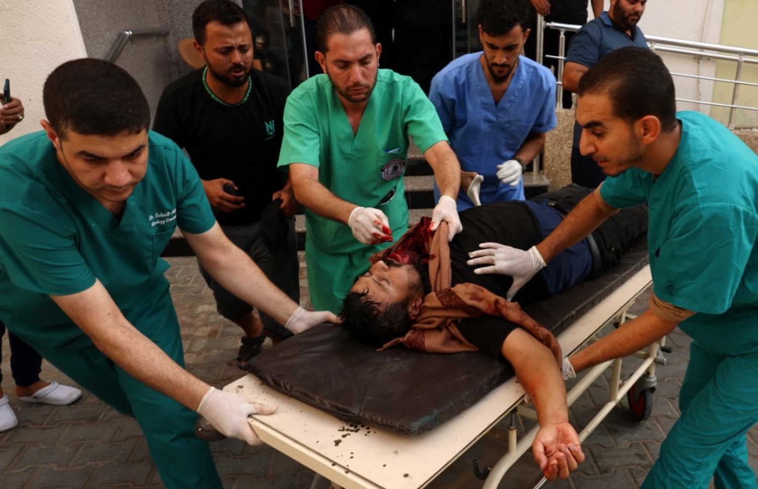 އިޒްރޭލުން ދިން ވައިގެ ހަމަލާއެއްގައި ޒަހަމްވި މީހަކަށް ފަރުވާ ދިނުމަށް ހޮސްޕިޓަލުގައި.-- ފޮޓޯ: އޭއެފްޕީ