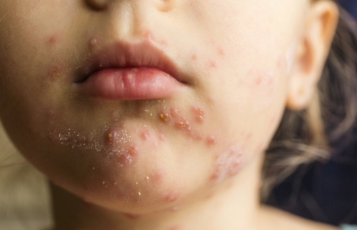 ފާނަބަސަންދު ޖެހިފައިވާ ކުއްޖެއް.