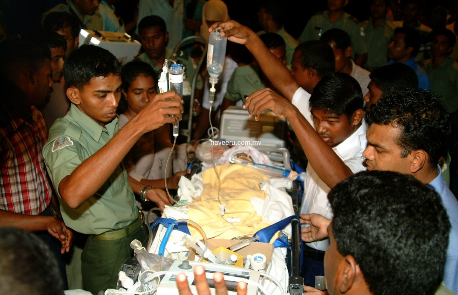 އެނަމާ ބޯޓުގެ ހާދިސާގައި ލޮނުބޮވި އެންމެ ހާލު ބޮޑުވި އެއް އަހަރުގެ ތުއްތު ކުއްޖާ ހޮސްޕިޓަލަށް ގެންދަނީ: އޭނާ މަރުވީ ލަންކާގައި ފަރުވާ ކުރަނިކޮށް -- ފޮޓޯ: މިހާރު