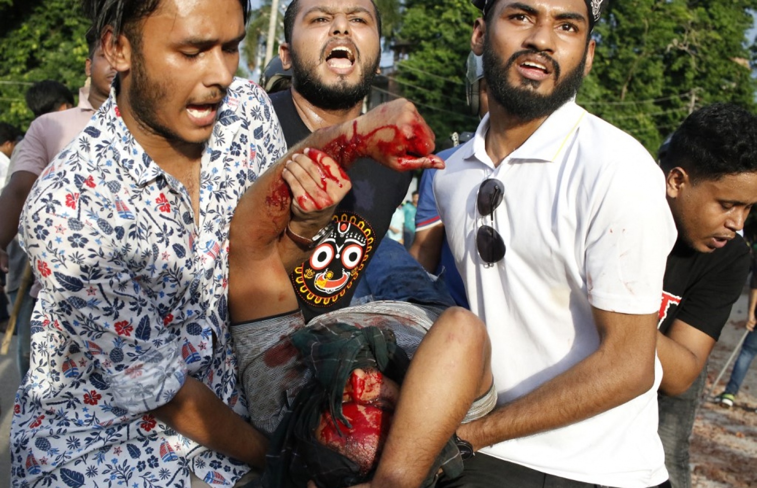 ބަންގްލާދޭޝްގައި ދަރިވަރުން ކުރަމުން ގެންދާ މުޒާހަރާގައި އިއްޔެ ހަމަނުޖެހުން ހިނގުމުގެ ސަބަބުން ޒަހަމްވި މީހަކަށް ފަރުވާ ދިނުމަށް ގެންދަނީ. -- ފޮޓޯ: އޭއެފްޕީ