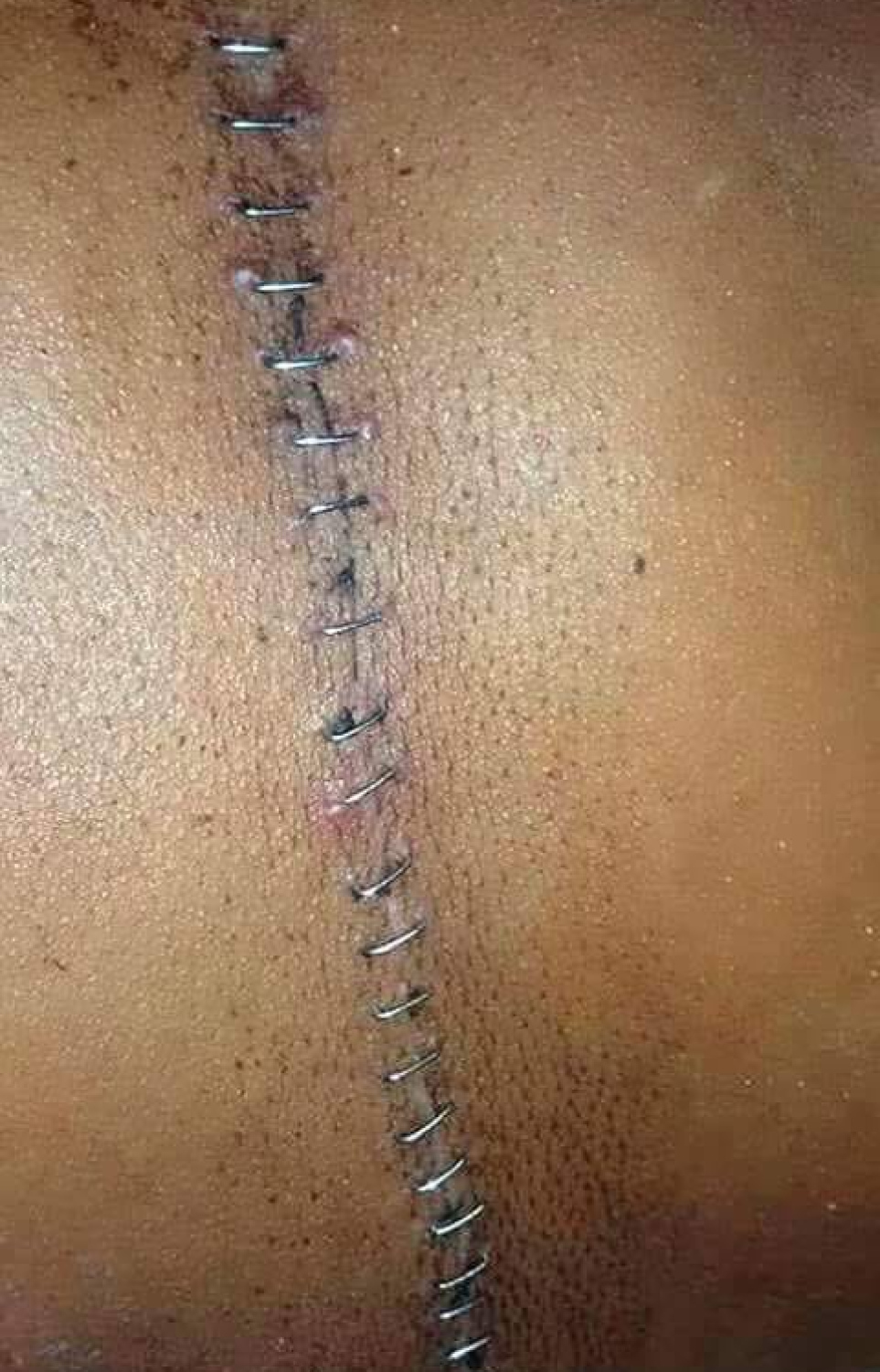 އަފްރާހުގެ މައިބަދަދައިގެ ސާޖަރީއަށް ފަހު ފަހާފައި