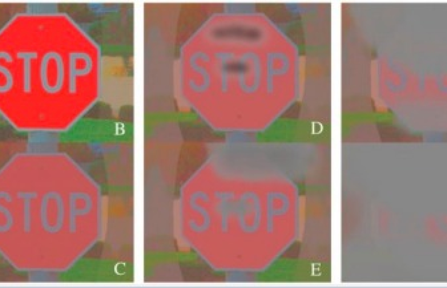 ގްލައުކޯމާ ޖެހިފައިވާ މީހަކަށް މަންޒަރެއް ފެންނަ ގޮތް.