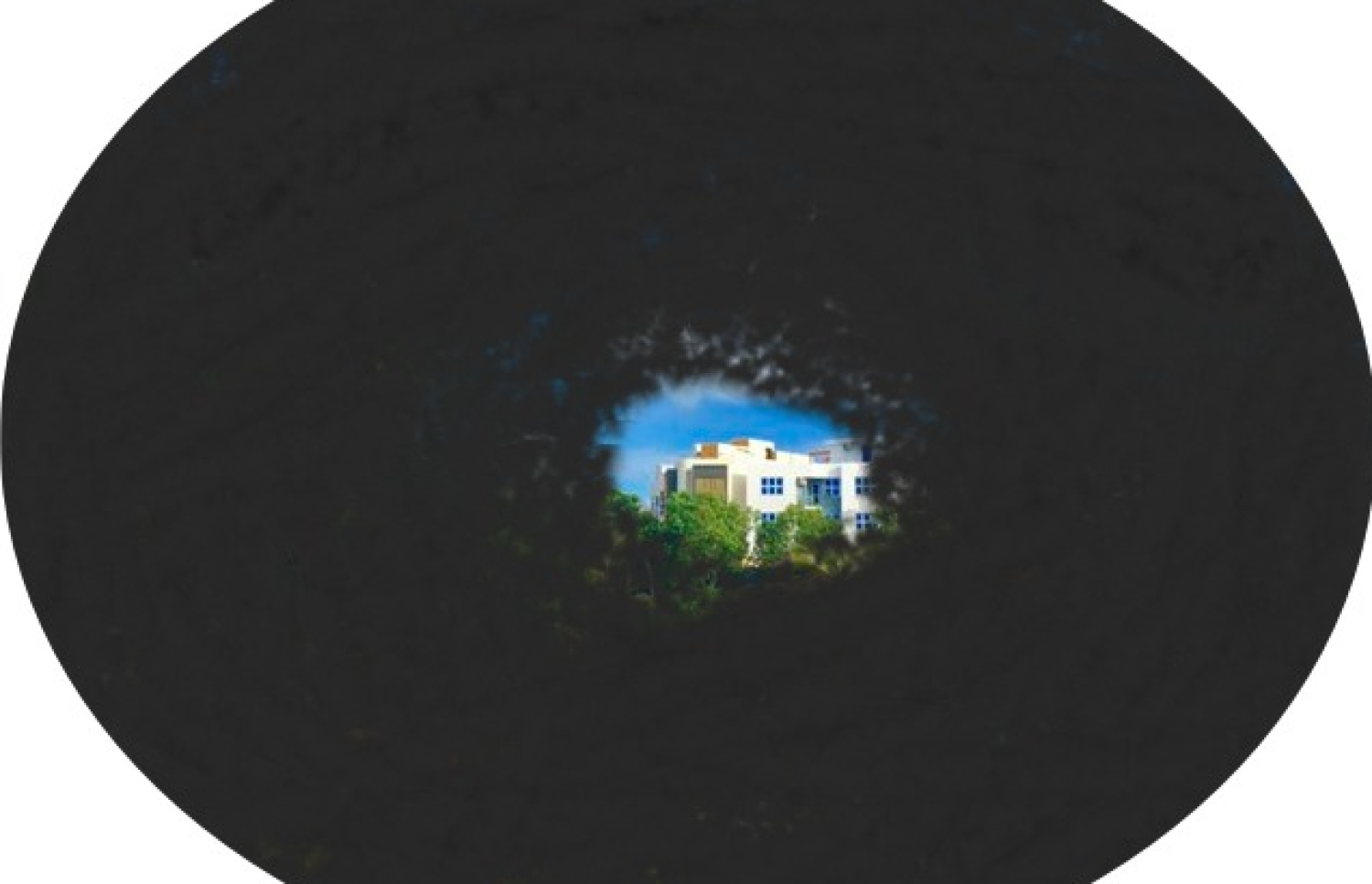 ގްލައުކޯމާ ޖެހިފައިވާ މީހަކަށް މަންޒަރެއް ފެންނަ ގޮތް.