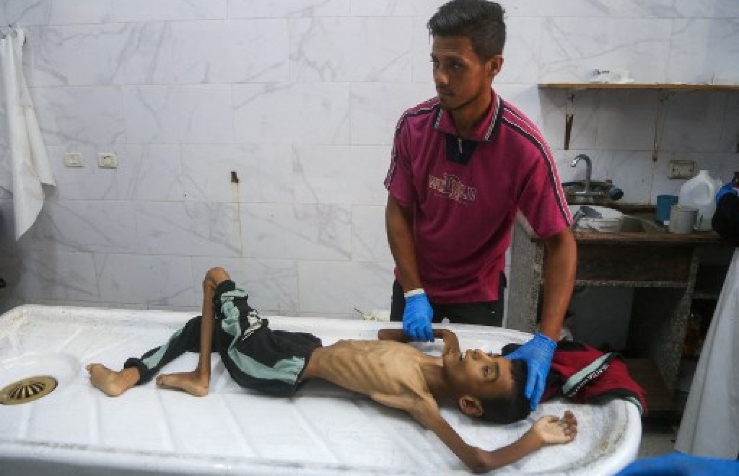 ކާން ނުލިބި އަނަރޫފަވެފައިވާ ކުއްޖަކަށް ޣައްޒާގެ ހޮސްޕިޓަލެއްގައި ފަރުވާދެނީ. -- ފޮޓޯ: އޭއެފްޕީ