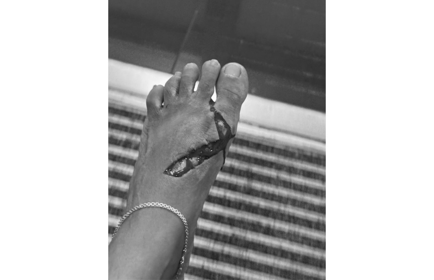 ޕެޑަލްގައި ޖެހި، އައިޝާގެ ފަޔަށް ކަފައިގެން ގޮސްފައި.