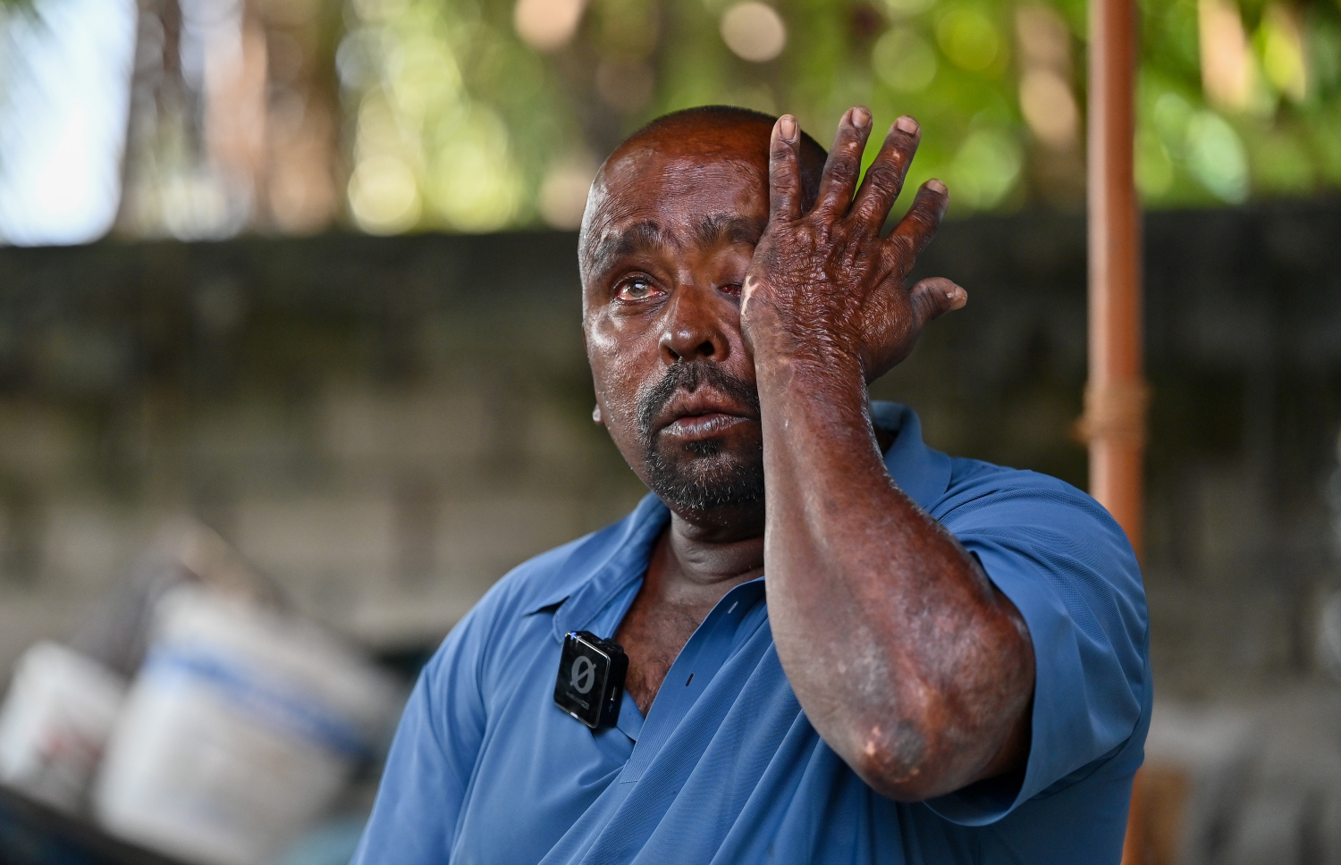 ޔޫނުސްގެ ހަޔާތުގައި ކުރި އެންމެ ހިތްދަތި ތަޖުރިބާ، "މިހާރު"އާ ހިއްސާކުރާއިރު ލޮލުން އުހުނު ކަރުތައް ފުހެލަނީ.-- ފޮޓޯ: ފަޔާޒު މޫސާ/ މިހާރު