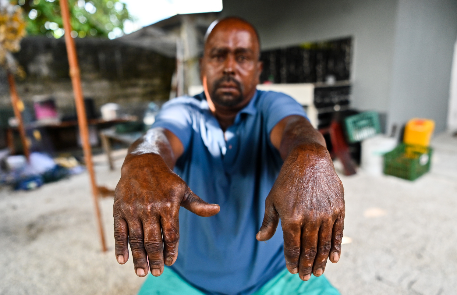 އަލިފާނުގައި ޔޫނުސްގެ އަތަށް ލިބުނު އަނިޔާތައް ދައްކާލަނީ.-- ފޮޓޯ: ފަޔާޒު މޫސާ/ މިހާރު